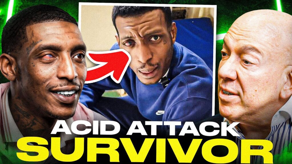 I SURVIVED AN ACID ATTACK” | Sticky Wivit’s Incredible Story