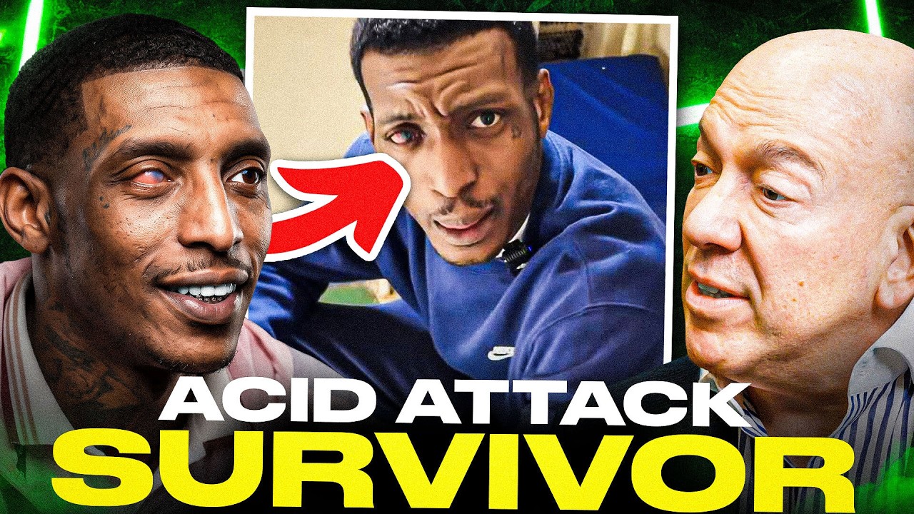I SURVIVED AN ACID ATTACK” | Sticky Wivit’s Incredible Story